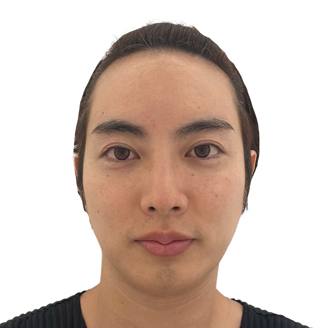 マヌカフェイシャル（ダーマペン4）